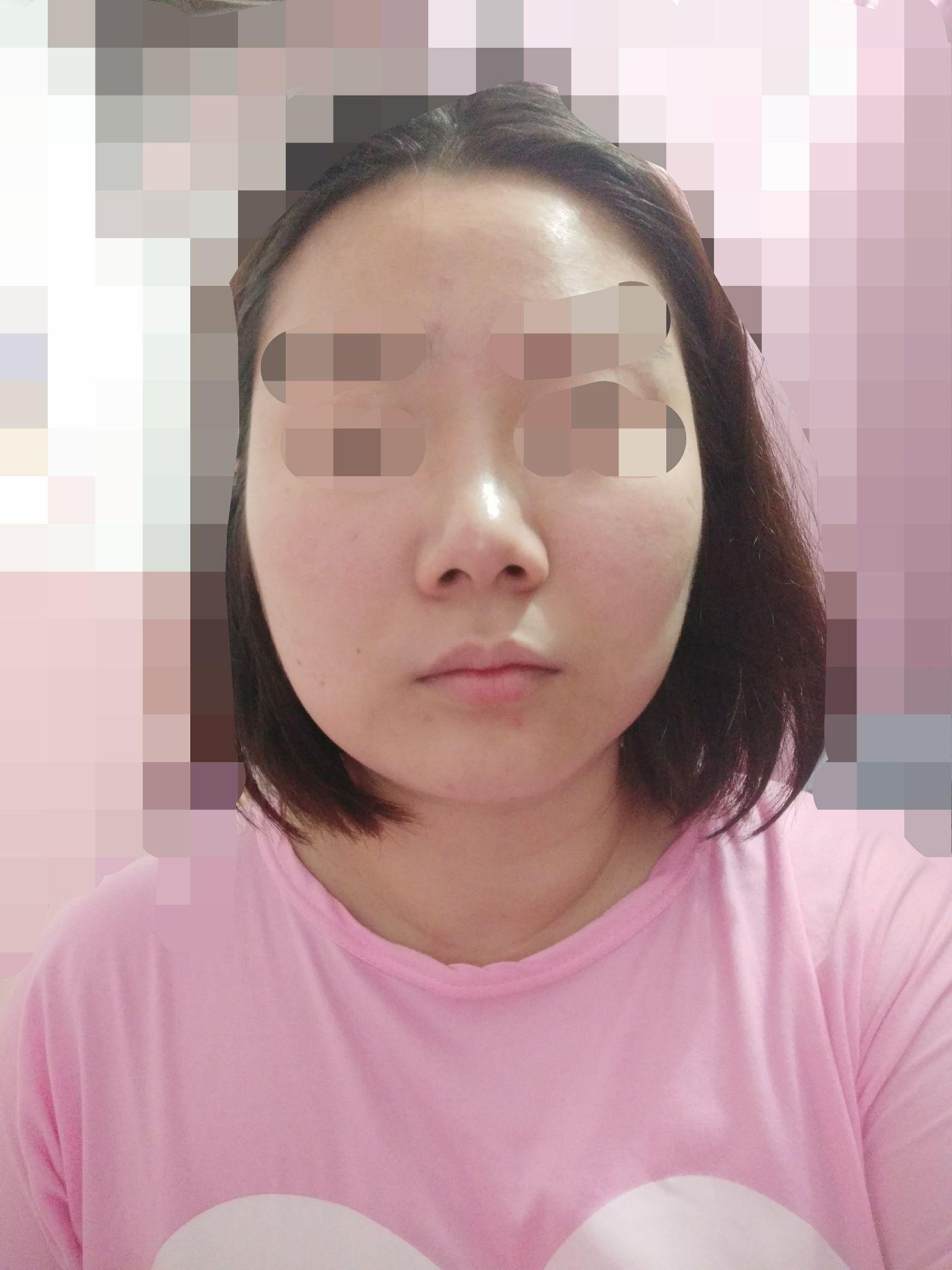 脸一边大一边小,是什么原因? - 知乎