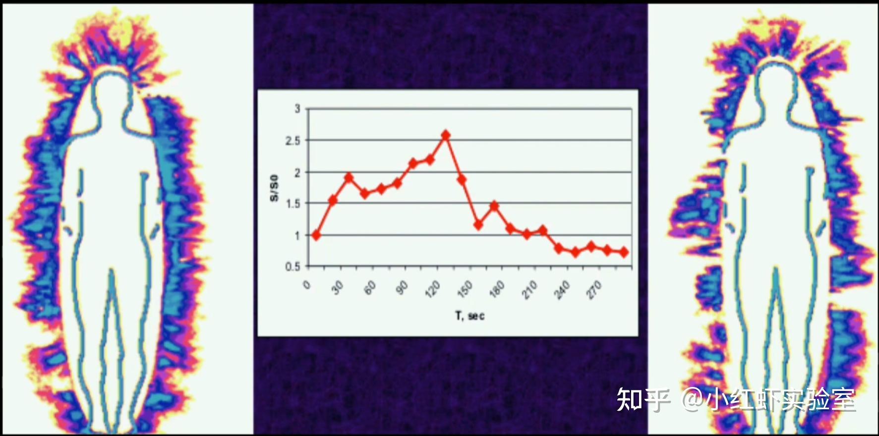人体存在一圈光晕?科学家说:发光的颜色能辨别人的健康状况 - 知乎