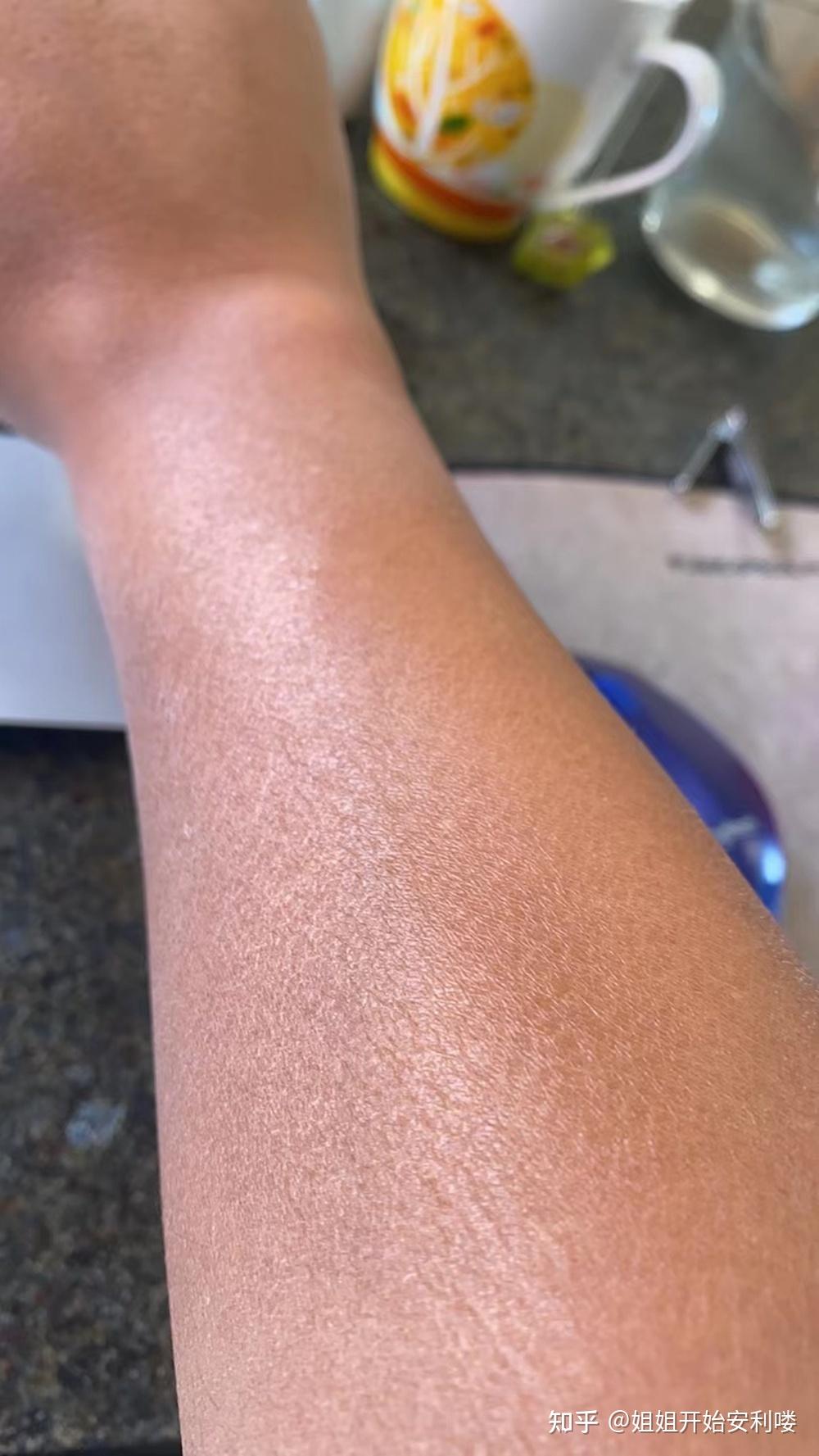 秋冬身上干燥脱皮,擦身体乳又很油很闷怎么办? - 知乎