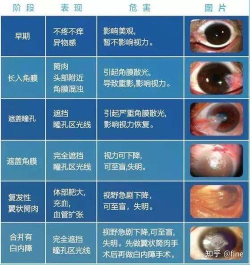 知乎