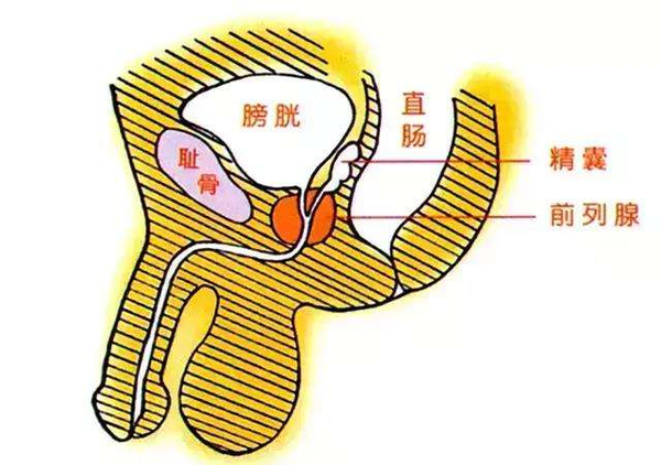 前列腺鈣化怎麼辦需要治療麼