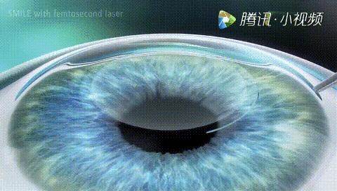 v2-8b6fd6e4467e2c1a75f5961bb4c95f15_r.jpg