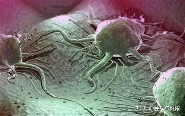 肺癌晚期一般能活多久