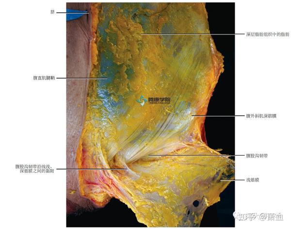 腹壁浅筋膜图片