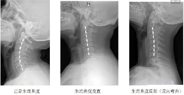 v2-8c976ac484f87f16086d9da697eb6dc2_1440w.jpg?source=172ae18b