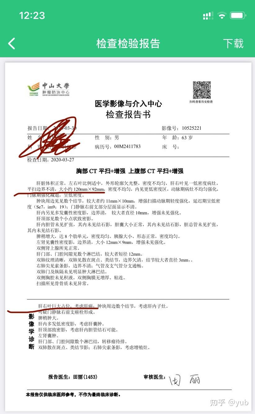 我爸的抗肝癌经历1:确诊,肿瘤12cm! - 知乎