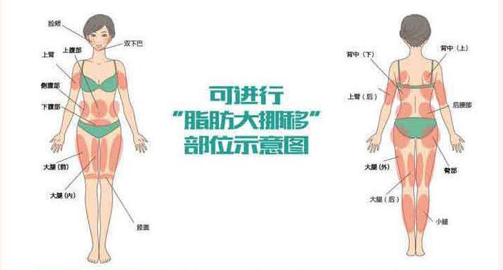 脂肪移植填充了解一下 知乎
