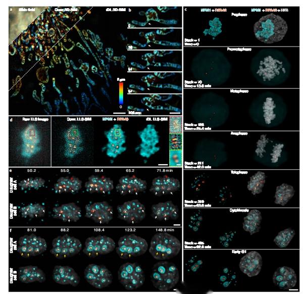 Nat Biotechnol 用于快速亚细胞过程持续实时成像的合理化深度学习超分辨率显微镜 知乎