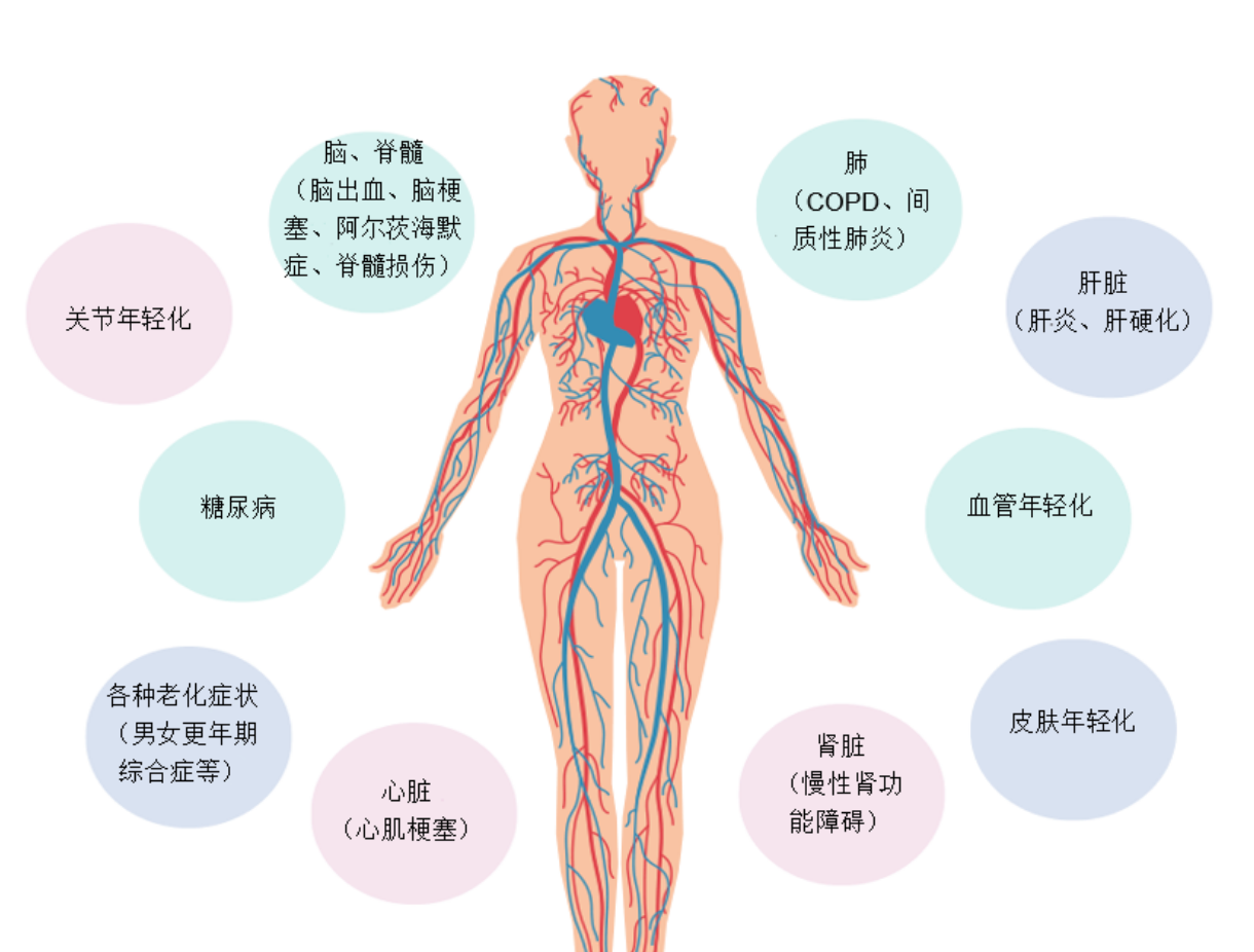 中科西部干细胞研究院脑中风脑梗脑出血原因干细胞是如何治疗的