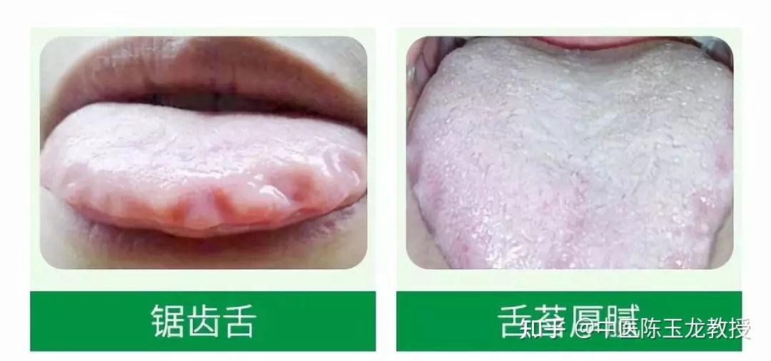 痰多湿气盛、惊悸不寐?送你一方,切断生痰之源,灭掉生痰之本 - 知乎