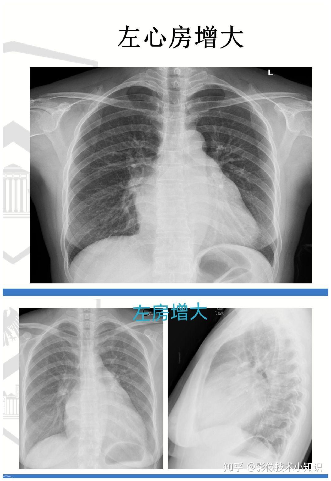 对你很有帮助的心脏影像知识