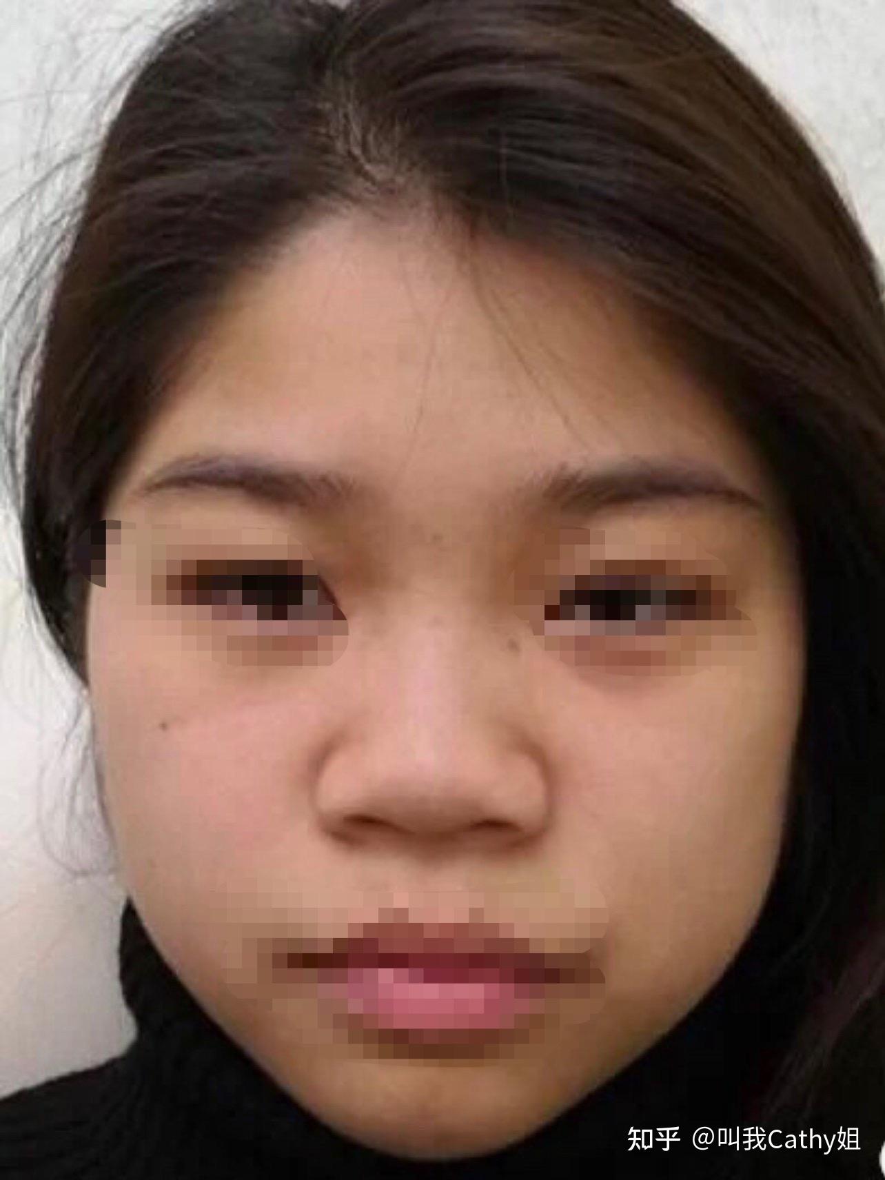 院长级,美国射极峰综合鼻整形研究院首批高级特聘专家从事整形美容15