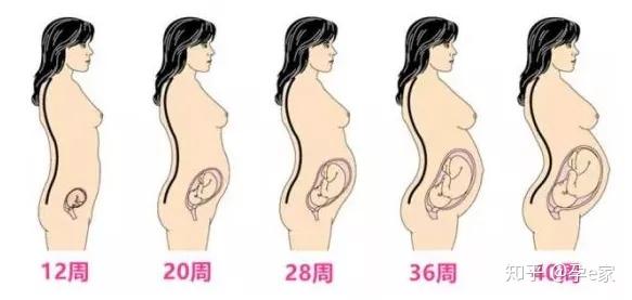 10个产妇9个腰痛 是月子病 还是麻醉后遗症 知乎