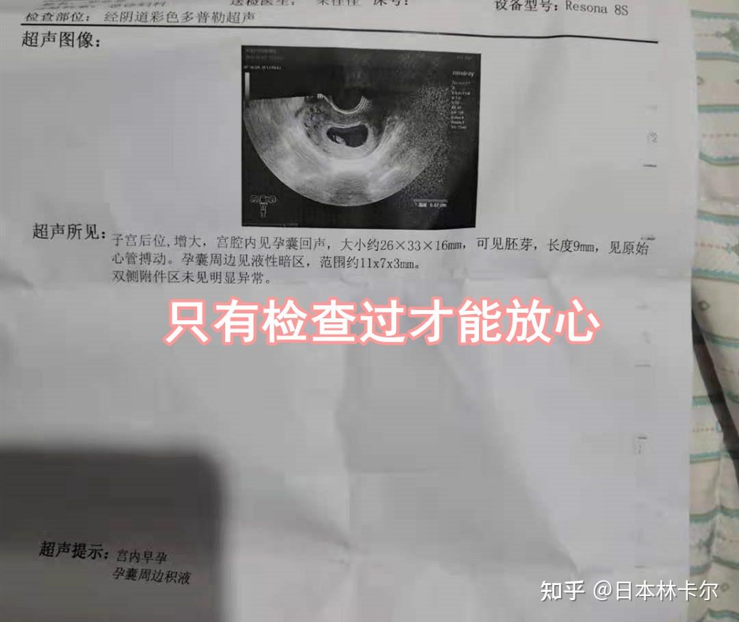 宫外孕为什么会持续性出血？—长沙江湾医院 - 知乎