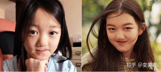 武大女神校花黄灿灿做整形如今也成馒头脸通天鼻然而骨相bug依旧存在