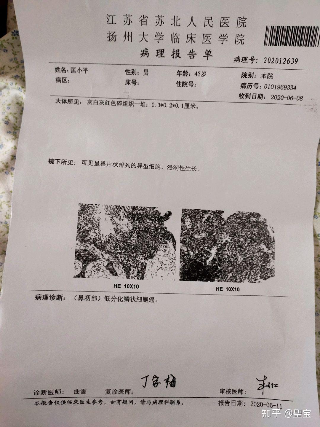 43岁父亲患鼻咽癌,寒门学子发起求助