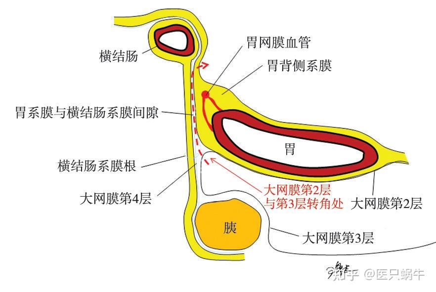 池畔专题结直肠解剖图谱及手术技巧分享01