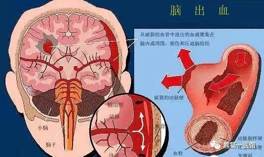 一次便秘,引发的血案,震惊所有人