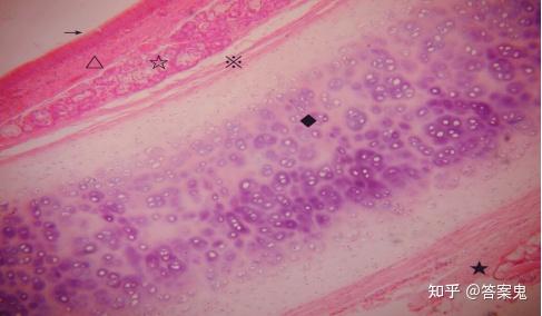 由透明软骨(◆)及结缔组织(★)构成的外膜,并可见明显的软骨膜(※)