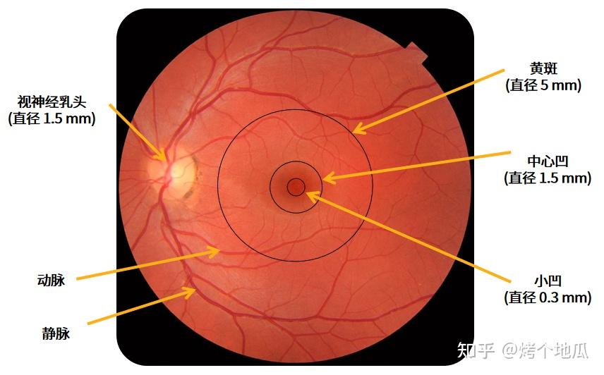 包括视网膜,视盘,黄斑和视网膜中央动静脉