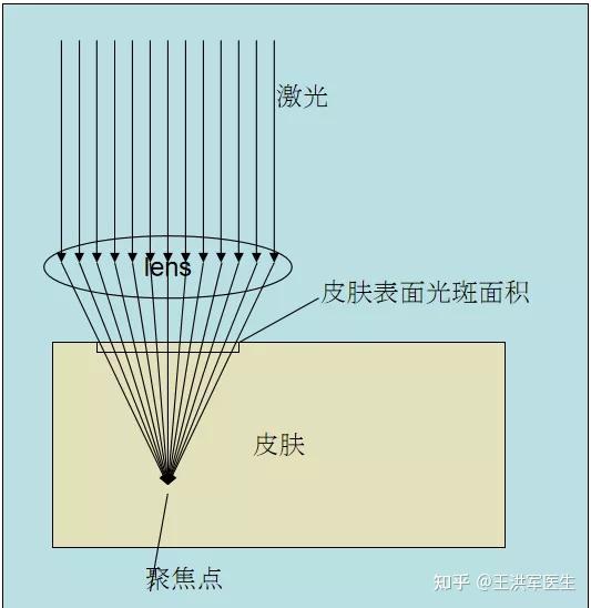 飞梭雷射Fraxel, 美白、缩毛孔效果好! - 知乎
