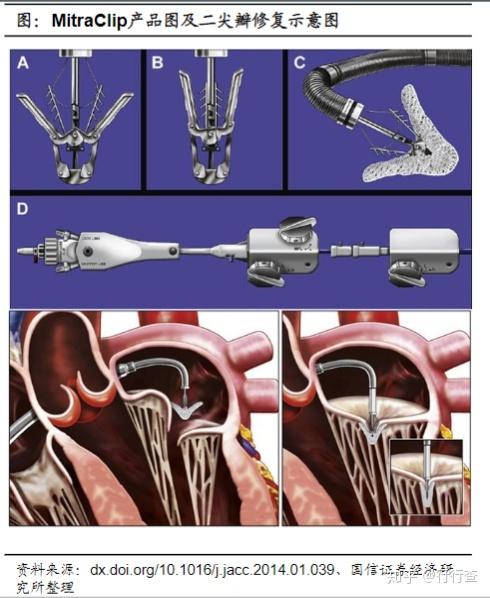 浅析人工心脏瓣膜的发展