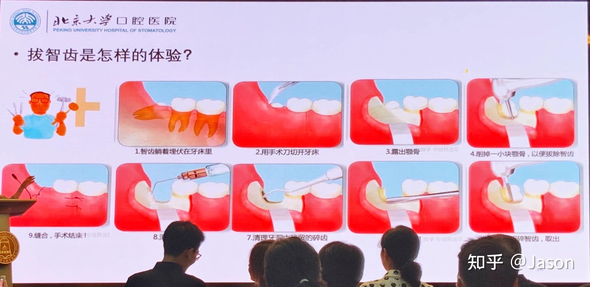 关于北大口腔医院、密云区多年在用的黄牛挂号助手，办事特别稳妥的信息