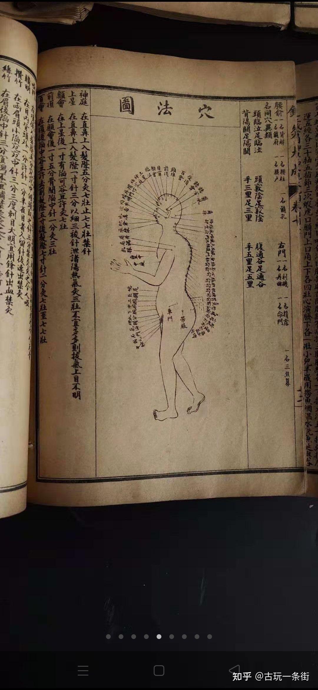 鍼灸大成 　上・下巻 中医古籍第一善本《针灸大成》[明]杨继洲著.康熙19年1680年.李