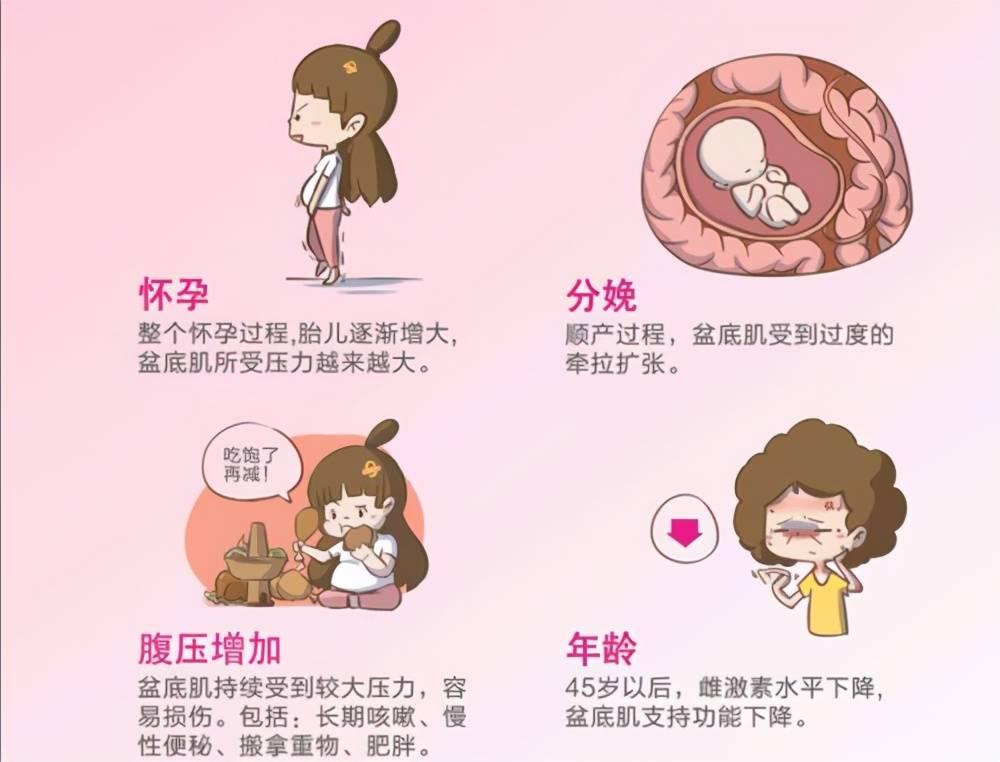 健康科普 | 女性的难言之隐——漏尿了，怎么办？ - 知乎