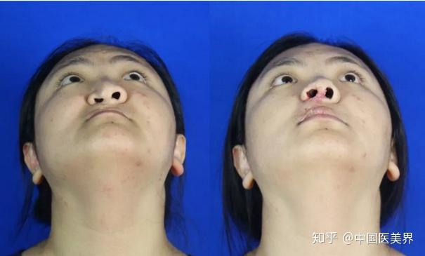 颅颌面外科整形专家柴岗教授