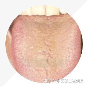 史上最全舌诊图谱!【珍藏版】 - 知乎