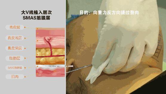 v2-8f6415e26ffb703714470bf21ee9e581_1440w.jpg?source=172ae18b