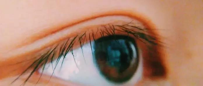 一双正常健康的眼睛长啥样 眼科医生给出四个标准答案 知乎