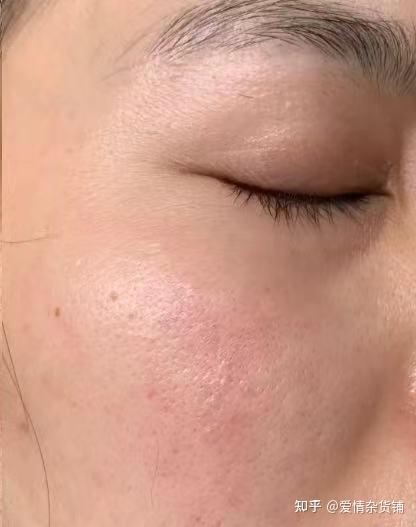 皮肤暗黄怎么提亮?有什么好用不贵的美白精华吗?