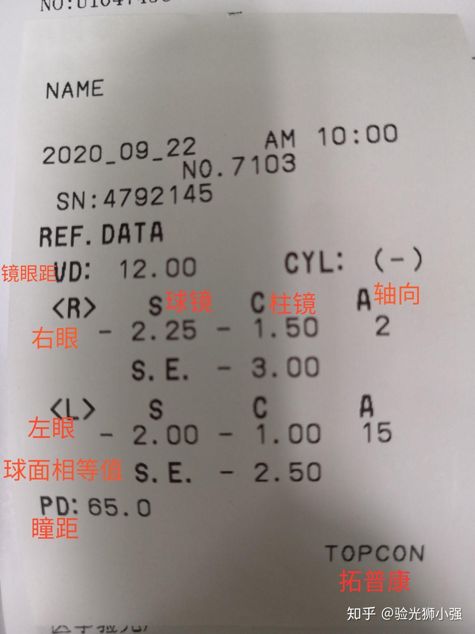 有没有眼科医院工作或者懂这方面的帮忙告知我这个验光单上的数据主要