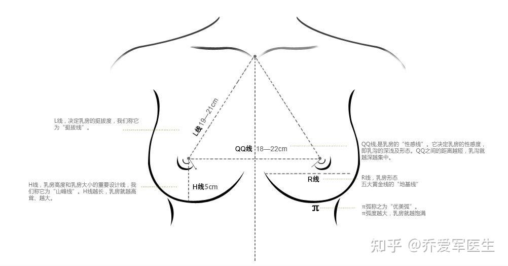 在植入的過程中進行體積增大,改善醜陋的胸型,進行乳房美學形態塑造