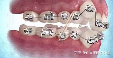 v2-9083b9b9d0b5ca8e7d5ecfe84665d749_r.jpg