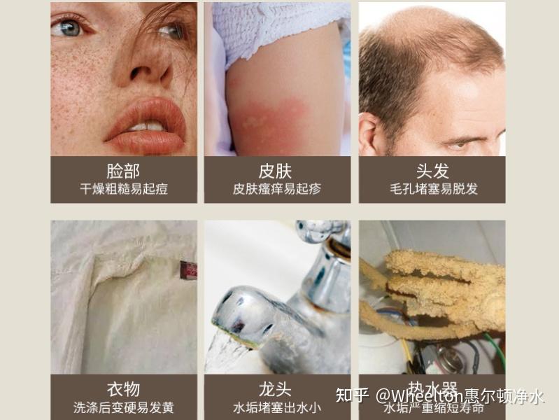 中央软水机亚硫酸钙净化悬浮物,有效制止微生物滋生,吸附异味与余氯