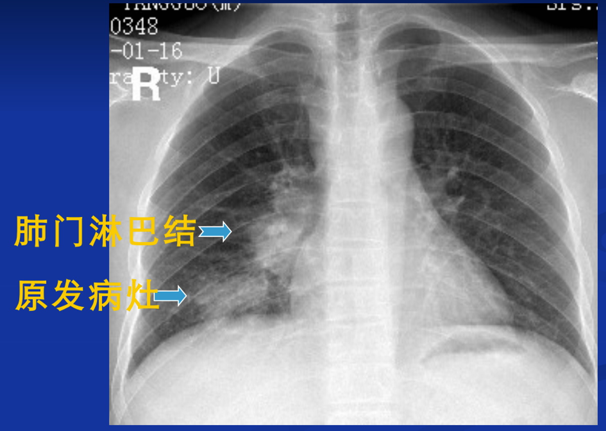 执业医师考试:影像诊断专项-X光(X线)平片系列 - 知乎