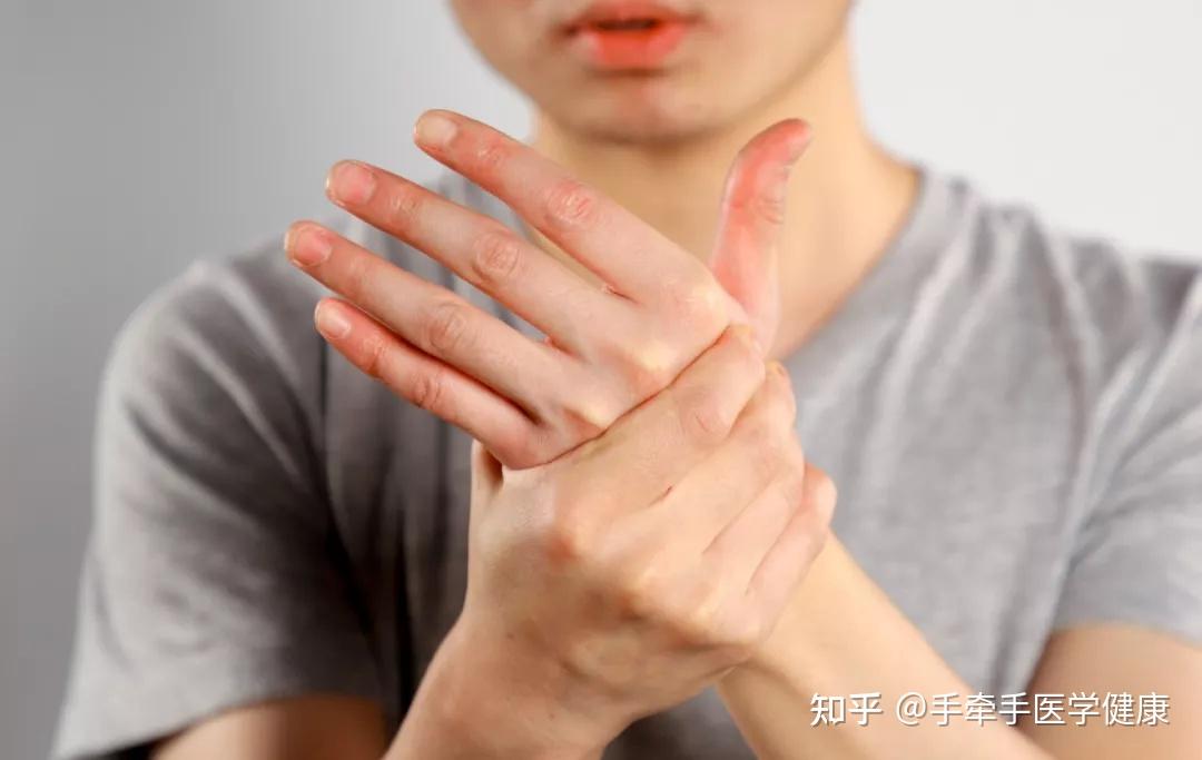 类风湿关节炎患者看病时没空讲的医生现在告诉你