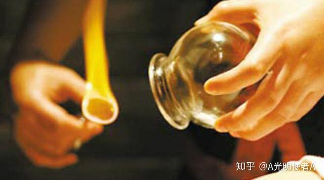 颈椎病的理疗试试拔罐法吧拿走就用