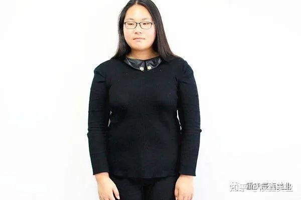 当女性雌激素过高荷尔蒙分泌旺盛时身体有何表现