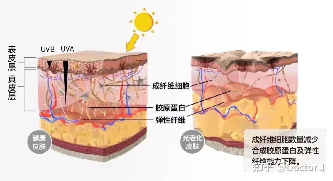 光老化有那么重要么？ - 知乎