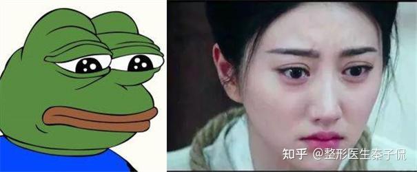 范冰冰和景甜同样是欧式大双眼皮,为什么景甜的看起来像悲伤蛙?