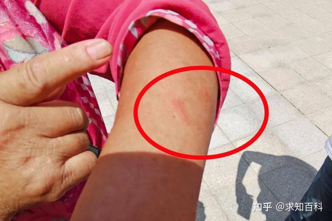 美国的红火蚁阵痛