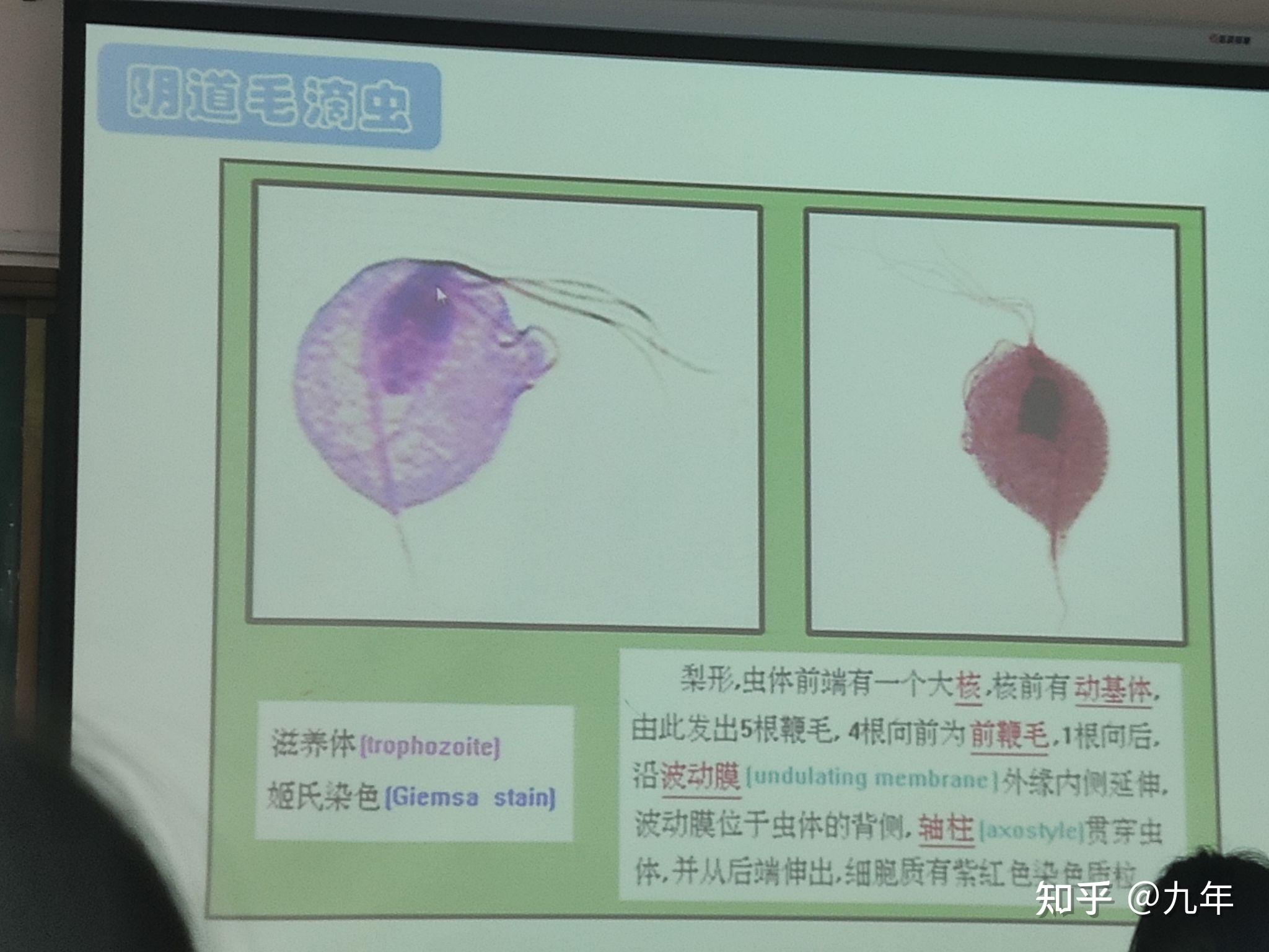 杜氏利什曼原蟲利杜體杜氏利什曼原蟲鞭毛體間日瘧原蟲環狀體間日