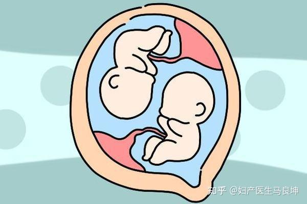 “一举得俩”的事儿,不是谁都行!什么样的孕妈更容易怀双胞胎? - 知乎