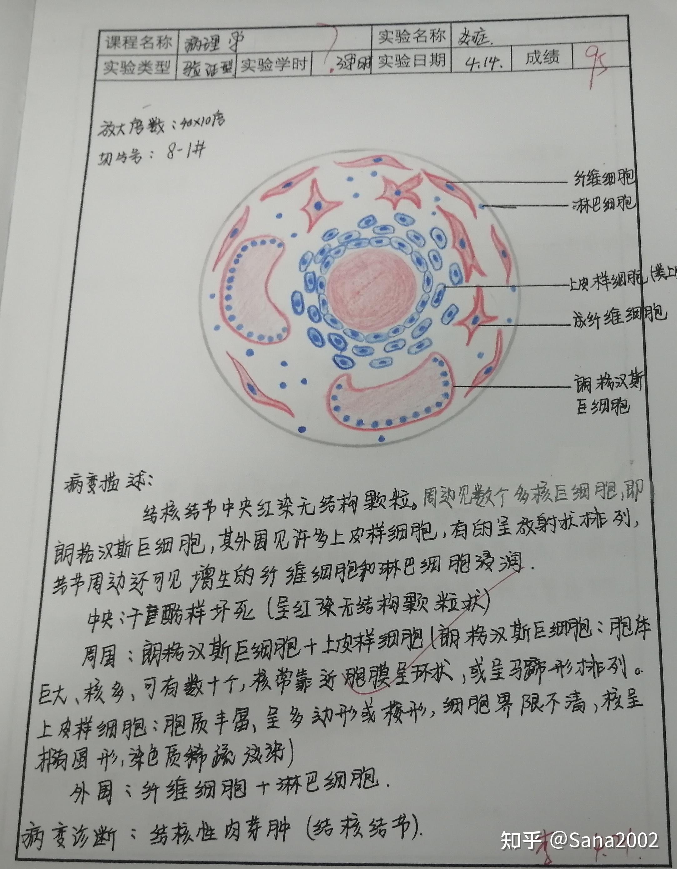 病理學實驗紅藍鉛筆圖醫學生