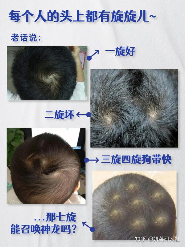 发旋是怎么来的？你有几个旋儿？ - 知乎