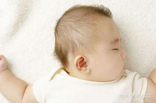 树袋宝宝提醒:宝宝枕秃正常还是缺钙?怎么预防宝宝枕秃 - 知乎